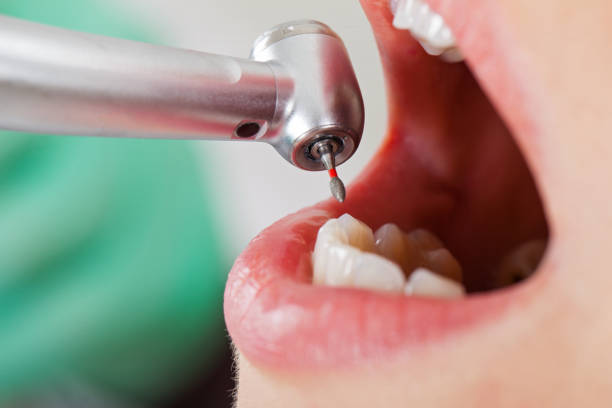 Best Cracked Tooth Emergency Dentist  in Kutztown, PA